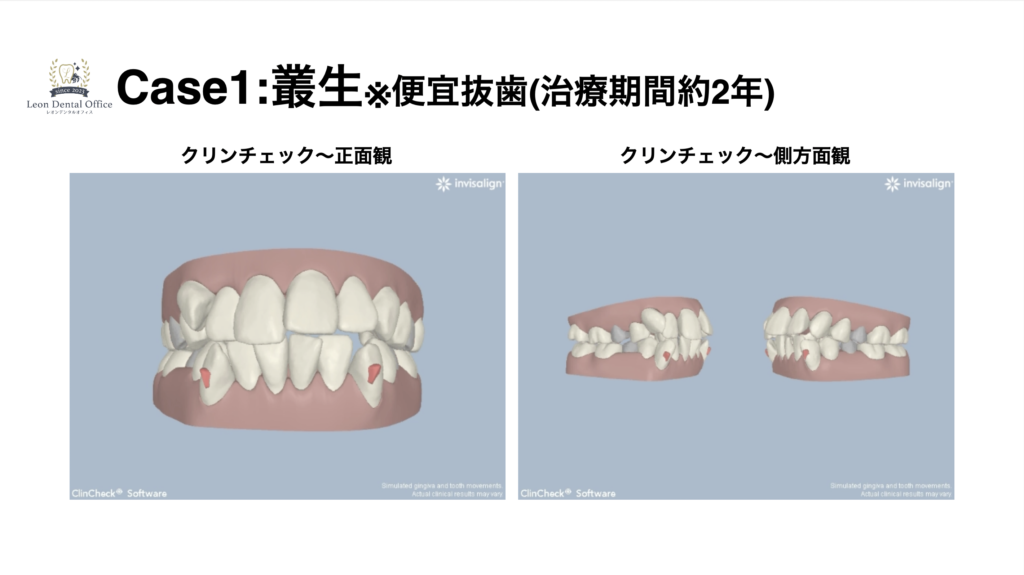 Screen Shot 2023-09-11 at 16.23.01